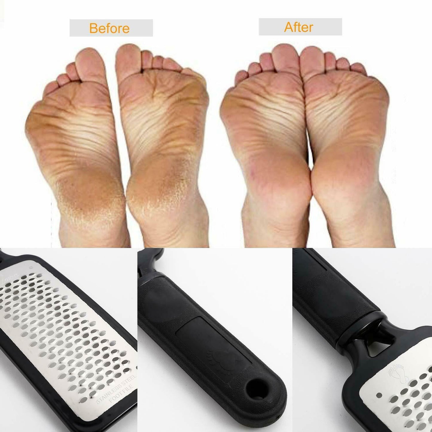 Professional Foot Callus Remover File Rasp Scraper Cracked Pedicure Rough Tool