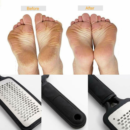 Professional Foot Callus Remover File Rasp Scraper Cracked Pedicure Rough Tool