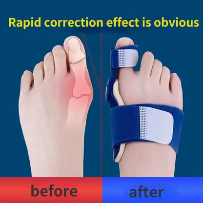 2pcs Big Bone Toe Bunion Splint Straightener Corrector Foot Pain Relief Hallux Valgus Feet Care Protector Foot Care Tools 5~8days