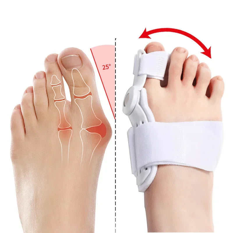 2Pcs Orthopedic Bunion Corrector Device Hallux Valgus Toe Correction Pedicure Foot Care Tool Thumb Big Bone Orthotics 7~10days